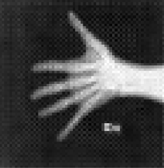Reconstruction attempt