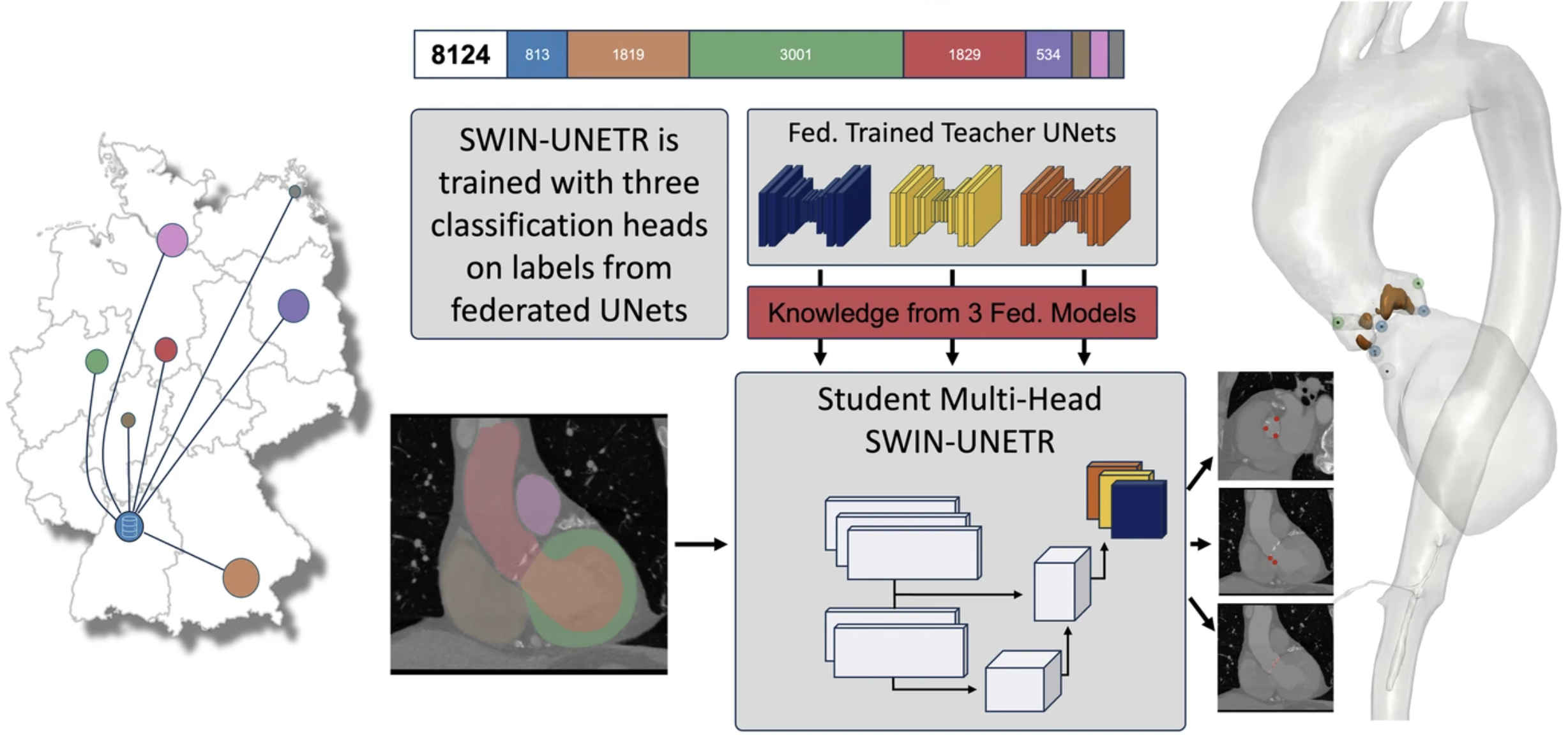Real-world Federated Learning for Cardiac CT Imaging